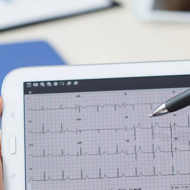 Modern cardiologists analyzing patient's electrocardiogram on tablet